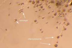 Sporangia & chlamydospores