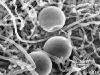 Chlamydospores Chlamydospores