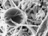 Chlamydospore Chlamydospore
