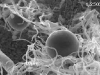 Chlamydospores Chlamydospores