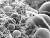 Chlamydospores Chlamydospores