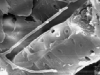 Hyphae in xylem Hyphae in xylem