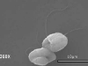Zoospores Zoospores