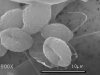 Zoospores Zoospores