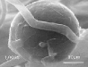 Chlamydospore Chlamydospore