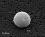 P. ramorum cyst P. ramorum cyst