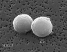P. ramorum cysts P. ramorum cysts