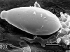 Zoosporangia Zoosporangia