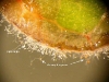 Sporulation Sporulation