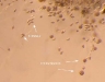 Sporangia & chlamydospores Sporangia & chlamydospores