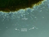 Sporangia Sporangia